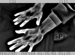 image of hands from the Palm IR 250 Pro infrared camera