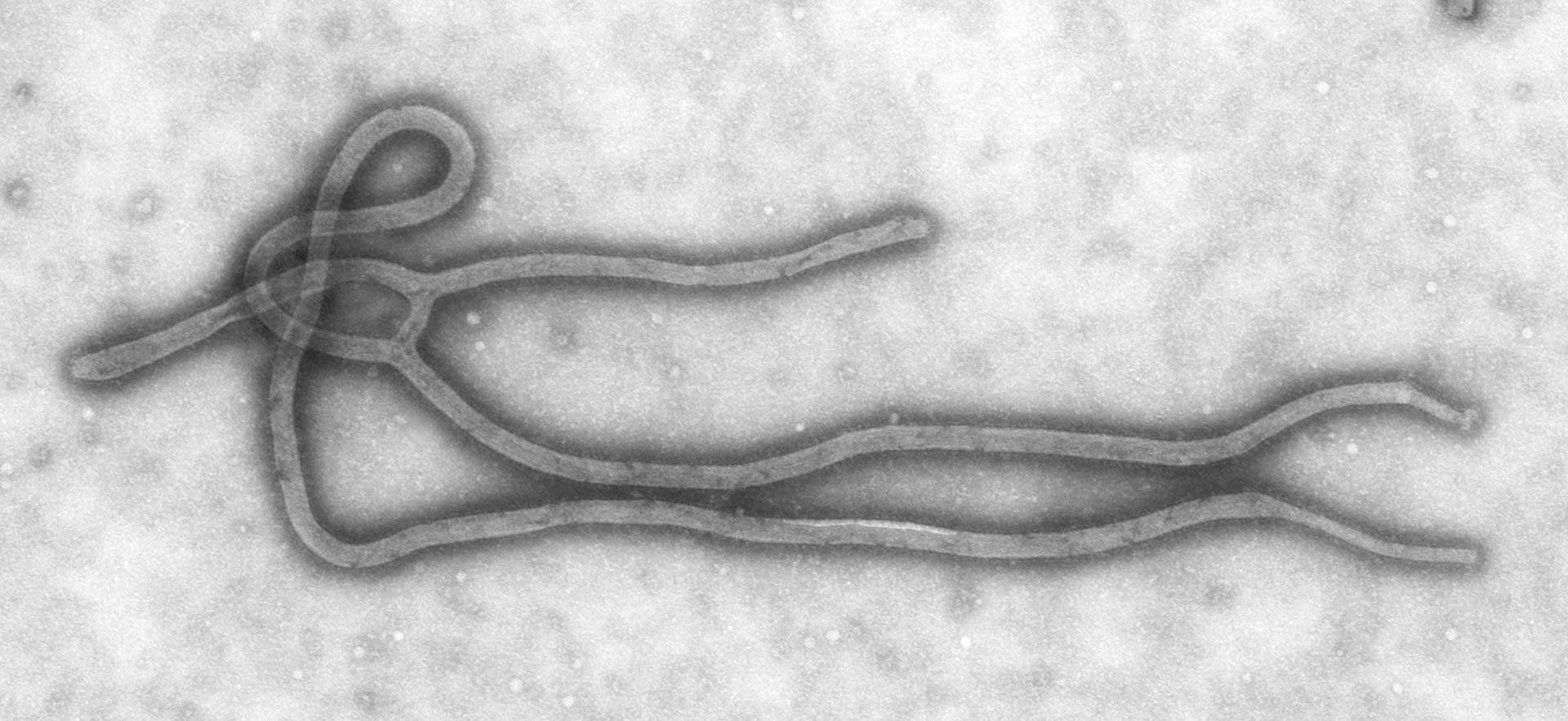 Ebola Virus through a microscope